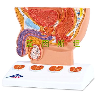 男性前列腺模型/生殖器官/摄护腺